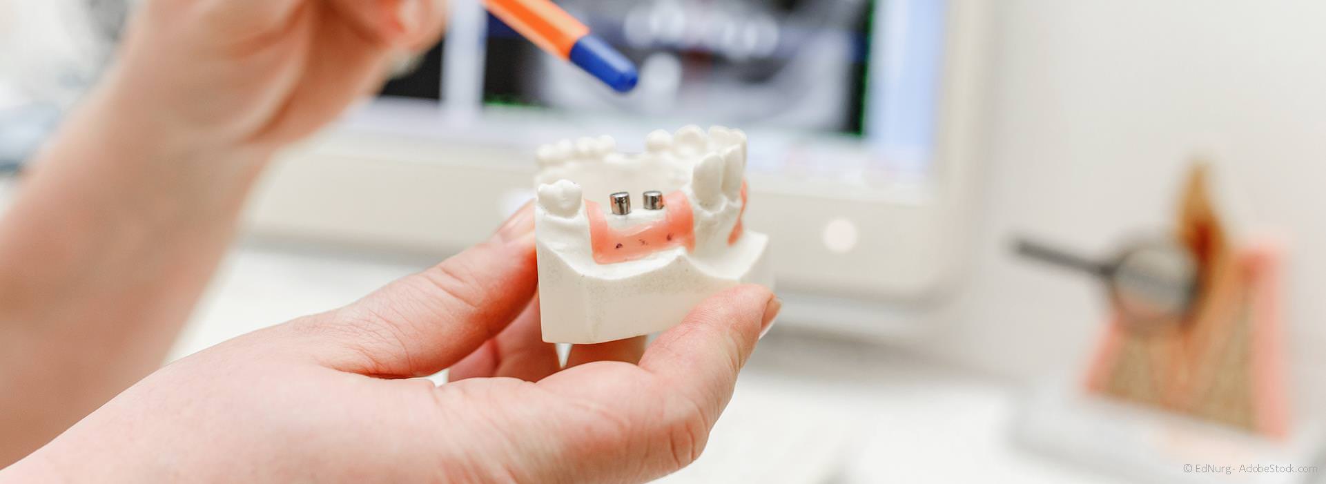PZR bei Zahnersatz, Implantaten und Kieferorthopädie